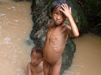 오염된 물에 노출된 어린이